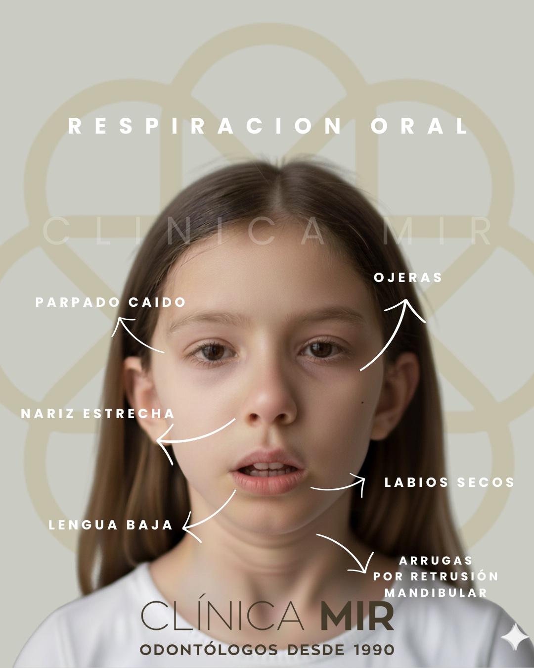 La respiración oral: un hábito silencioso que afecta al desarrollo facial